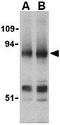 PR/SET Domain 1 antibody, GTX31755, GeneTex, Western Blot image 