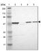 Hyaluronidase 1 antibody, NBP1-83409, Novus Biologicals, Western Blot image 