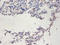 Telomerase Reverse Transcriptase antibody, A53505-100, Epigentek, Immunohistochemistry paraffin image 