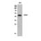 CD47 Molecule antibody, STJ96874, St John