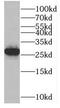 HsMAD2 antibody, FNab04923, FineTest, Western Blot image 
