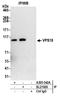 Vacuolar protein sorting-associated protein 18 homolog antibody, A305-542A, Bethyl Labs, Immunoprecipitation image 