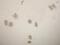 Plasminogen Activator, Urokinase Receptor antibody, ab103791, Abcam, Immunocytochemistry image 