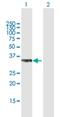 Protein Phosphatase 2 Catalytic Subunit Beta antibody, H00005516-B01P, Novus Biologicals, Western Blot image 