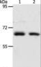 Acyl-CoA Thioesterase 11 antibody, LS-C401159, Lifespan Biosciences, Western Blot image 