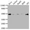 FAS antibody, CSB-RA252392A0HU, Cusabio, Western Blot image 