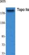 DNA Topoisomerase II Alpha antibody, F00953-1, Boster Biological Technology, Western Blot image 