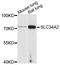 Solute Carrier Family 34 Member 2 antibody, STJ111708, St John