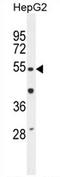 Tigger Transposable Element Derived 3 antibody, AP54251PU-N, Origene, Western Blot image 