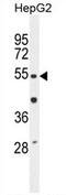 Tigger transposable element-derived protein 3 antibody, AP54251PU-N, Origene, Western Blot image 