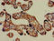 CD16 antibody, LS-C677925, Lifespan Biosciences, Immunohistochemistry paraffin image 