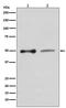 SLC9A3 Regulator 1 antibody, M02427, Boster Biological Technology, Western Blot image 
