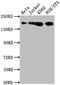 DNA Topoisomerase II Alpha antibody, CSB-RA696677A0HU, Cusabio, Western Blot image 