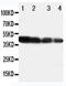 Delta Like Canonical Notch Ligand 3 antibody, LS-C313048, Lifespan Biosciences, Western Blot image 