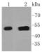 Keratin 14 antibody, A01432-2, Boster Biological Technology, Western Blot image 