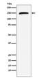 RAD50 Double Strand Break Repair Protein antibody, M00347, Boster Biological Technology, Western Blot image 