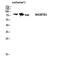 Rho Related BTB Domain Containing 3 antibody, A10214, Boster Biological Technology, Western Blot image 