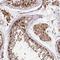 Dmx Like 1 antibody, NBP2-48656, Novus Biologicals, Immunohistochemistry frozen image 