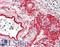 Collagen Type VIII Alpha 1 Chain antibody, LS-B11586, Lifespan Biosciences, Immunohistochemistry frozen image 