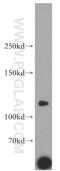 Leucyl And Cystinyl Aminopeptidase antibody, 55154-1-AP, Proteintech Group, Western Blot image 