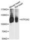 ATPase Sarcoplasmic/Endoplasmic Reticulum Ca2+ Transporting 2 antibody, A0098, ABclonal Technology, Western Blot image 