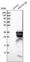 Protein Phosphatase 1 Regulatory Subunit 12B antibody, NBP1-87751, Novus Biologicals, Western Blot image 