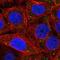 Proteasome 26S Subunit, Non-ATPase 6 antibody, NBP2-32677, Novus Biologicals, Immunocytochemistry image 