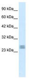 Hes Family BHLH Transcription Factor 7 antibody, TA329652, Origene, Western Blot image 