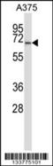 Protein Phosphatase 3 Catalytic Subunit Alpha antibody, 57-249, ProSci, Western Blot image 