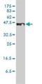 STEAP Family Member 1 antibody, H00026872-M01, Novus Biologicals, Western Blot image 