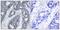 Insulin Receptor Substrate 1 antibody, GTX50265, GeneTex, Immunohistochemistry paraffin image 