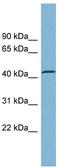 TBC1 Domain Family Member 13 antibody, TA344293, Origene, Western Blot image 