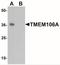 Transmembrane Protein 106A antibody, NBP2-41165, Novus Biologicals, Western Blot image 