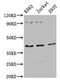 Adiponectin Receptor 1 antibody, CSB-PA001367LA01HU, Cusabio, Western Blot image 