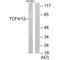 Transcription Factor 4 antibody, A00674, Boster Biological Technology, Western Blot image 