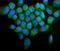 Serine/threonine-protein kinase PINK1, mitochondrial antibody, A00201-2, Boster Biological Technology, Immunofluorescence image 