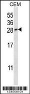 Placental Growth Factor antibody, 57-830, ProSci, Western Blot image 