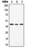Alpha-2-Glycoprotein 1, Zinc-Binding antibody, MBS820671, MyBioSource, Western Blot image 