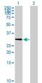 Zinc Finger Protein 511 antibody, H00118472-B01P, Novus Biologicals, Western Blot image 