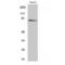 Myristoylated Alanine Rich Protein Kinase C Substrate antibody, LS-C384437, Lifespan Biosciences, Western Blot image 