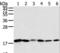 Sorting Nexin 3 antibody, LS-C406832, Lifespan Biosciences, Western Blot image 