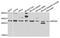 Bisphosphoglycerate mutase antibody, STJ110190, St John