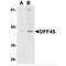 DNA Fragmentation Factor Subunit Alpha antibody, LS-B3186, Lifespan Biosciences, Western Blot image 