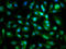 Sperm Associated Antigen 6 antibody, LS-C681440, Lifespan Biosciences, Immunofluorescence image 
