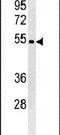 WD Repeat Domain 73 antibody, PA5-25221, Invitrogen Antibodies, Western Blot image 