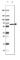 Glutamate Decarboxylase 2 antibody, AMAb91048, Atlas Antibodies, Western Blot image 