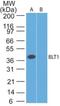 Leukotriene B4 Receptor antibody, NBP2-27422, Novus Biologicals, Western Blot image 