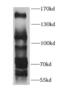 Lysine Demethylase 4A antibody, FNab04512, FineTest, Western Blot image 