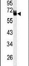 Leucine Rich Repeat Transmembrane Neuronal 1 antibody, PA5-26725, Invitrogen Antibodies, Western Blot image 