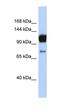 ATP Binding Cassette Subfamily A Member 2 antibody, orb330323, Biorbyt, Western Blot image 